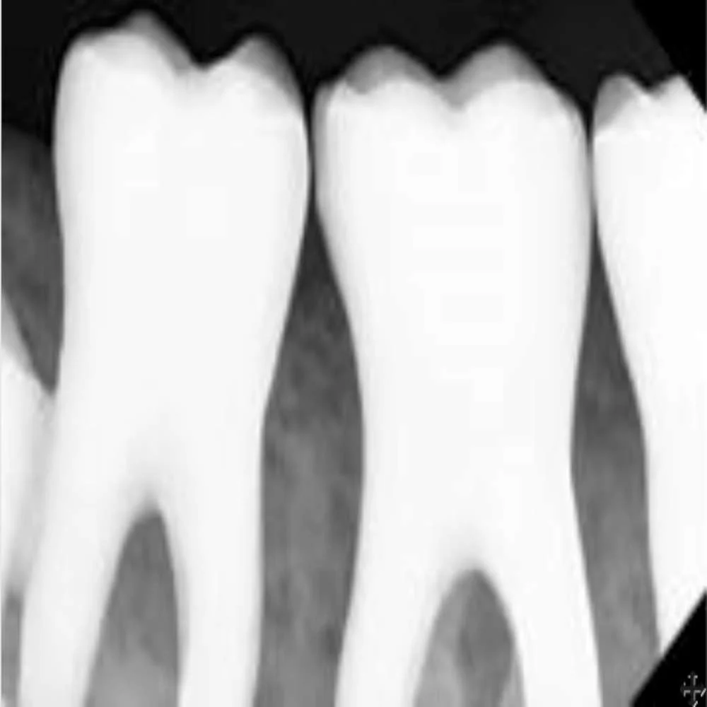 Digital Doc BLU Dental Digital Intraoral X-Ray Sensor Size 1 - Image 2